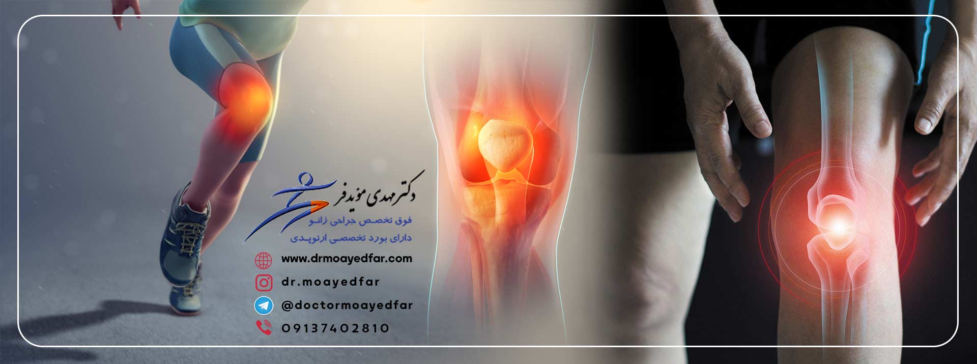 7584-بهترین-فوق-تخصص-درمان-بیماری-های-زانو-جراح-زانو-دکتر-متخصص-زانو-درد-زانو-اصفهان-knee-best-doctor-iran