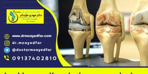 are total knee replacements successful, benefits of knee arthroplasty fellowship, benefits of knee arthroplasty surgery, benefits of knee replacement, can you kneel on a knee replacement, can you kneel on artificial knee, famous knee surgeons, knee arthroplasty, knee arthroplasty cpt, knee arthroplasty cpt code, knee arthroplasty definition, knee arthroplasty discharge teaching, knee arthroplasty icd 10, knee arthroplasty in iran cost, knee arthroplasty in iran pdf, knee arthroplasty in iran price, knee arthroplasty meaning, knee arthroplasty orthobullets, knee arthroplasty surgery, knee arthroplasty xray, knee replacement cost in iran, knee surgeon in iranian hospital, main cause for knee replacement, orthopedic surgeon salary in iran, potential risks and complications of acdf surgery, potential risks and complications of ringworm, potential risks and complications of vitiligo, potential risks or complications of athlete's foot, potential risks or complications of eczema, potential risks or complications of rosacea, reasons for knee arthroplasty fellowship, reasons for knee replacement, reasons for total knee arthroplasty, recovery and rehabilitation, recovery and rehabilitation after typhoon, recovery and rehabilitation difference, recovery and rehabilitation in mental health, recovery and rehabilitation meaning, recovery and rehabilitation plan, recovery and rehabilitation strategies, recovery and rehabilitation strategies in disaster response, recovery and rehabilitation tax clearance, recovery and rehabilitation wellness spa, the knee arthroplasty procedure codes, the knee arthroplasty procedure cpt code, the knee arthroplasty procedure duration, the knee arthroplasty procedure pdf, the knee arthroplasty procedure ppt, the knee arthroplasty procedure steps, the knee arthroplasty procedure take, the knee arthroplasty procedure video, the knee arthroplasty procedure youtube, the knee arthroplasty procedures, types of knee arthroplasty, what are the advantages and disadvantages of a knee replacement, what are the possible risks and complications of a d&c procedure, what are the potential risks and complications, what are the potential risks and complications of using an aed, what are the pros and cons of knee replacement surgery, what are the risks and complications involved with pcnl, what is a right total knee arthroplasty, what is a total knee arthroplasty definition, what is arthroplasty knee condyle and plateau, what is arthroplasty knee total, what is knee arthroplasty, what is knee arthroplasty unicompartmental, what is knee joint replacement, what is knee replacement surgery, what is knee replacements made of, what is left total knee arthroplasty, what is right knee arthroplasty, what is the main reason for knee replacement, what is total knee arthroplasty (tka), what is total knee arthroplasty revision 206-1-best-knee-بهترین-جراح-زانو-در-ایران-افضل-دوکتور-الرکبه-فی-ایران-اصفهان-arthroplasty-iran